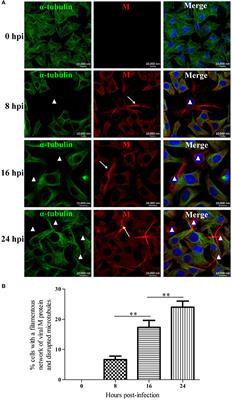 Rabies Virus Infection Induces Microtubule Depolymerization to Facilitate Viral RNA Synthesis by Upregulating HDAC6